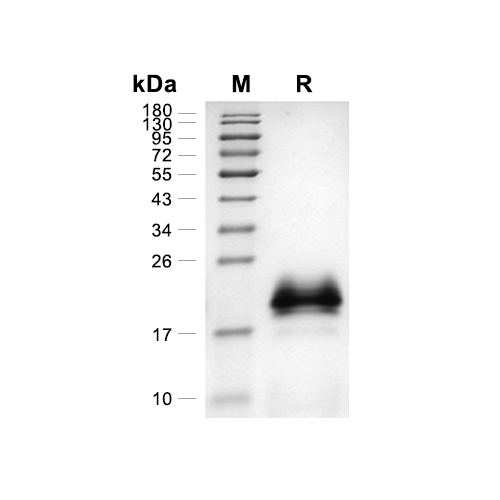 IL-4蛋白, Human (HEK293, His),IL-4 Protein, Human (HEK293, His)