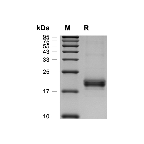 IL-17F蛋白, Human (HEK293, His),IL-17F Protein, Human (HEK293, His)