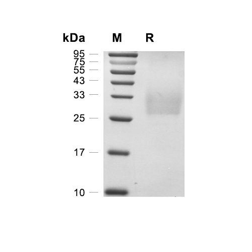 TREM-1蛋白, Human (HEK293, His),TREM-1 Protein, Human (HEK293, His)