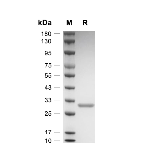 Galectin-3/LGALS3蛋白, Human,Galectin-3/LGALS3 Protein, Human