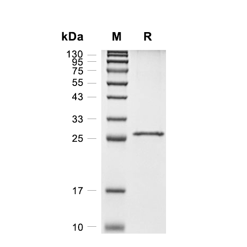 Grb2蛋白, Human (His),Grb2 Protein, Human (His)