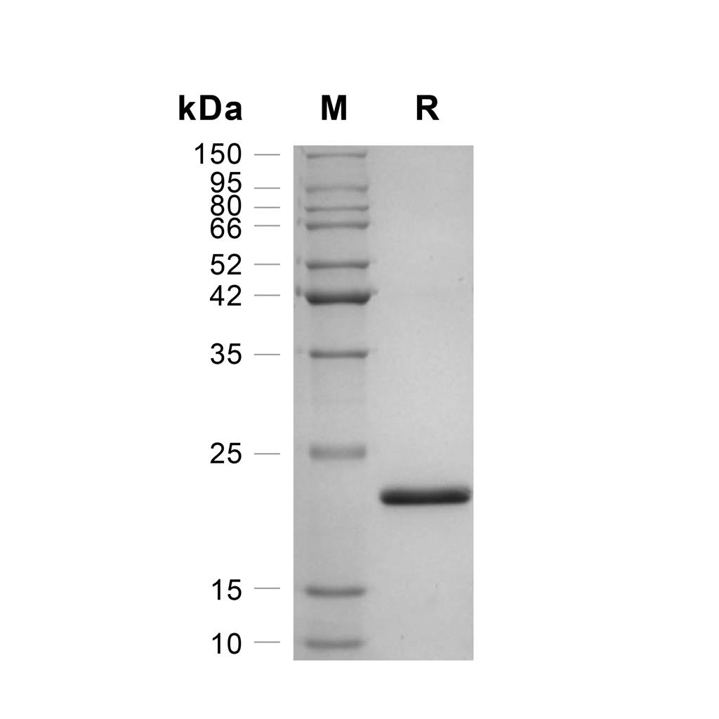 SHH蛋白, Human,SHH Protein, Human