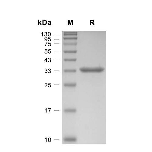 SULT1A1蛋白, Human (His),SULT1A1 Protein, Human (His)