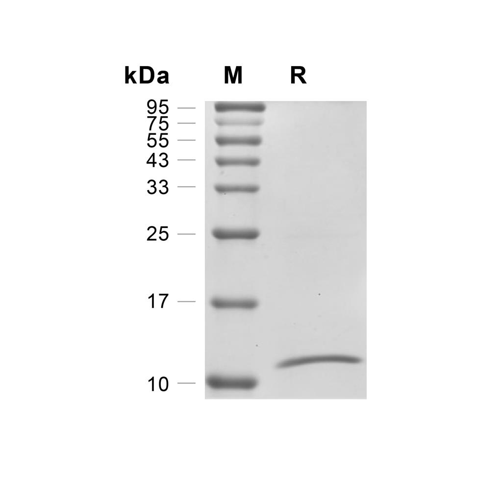TGF beta 2/TGFB2蛋白, Mouse/Rat (HEK293),TGF beta 2/TGFB2 Protein, Mouse/Rat (HEK293)