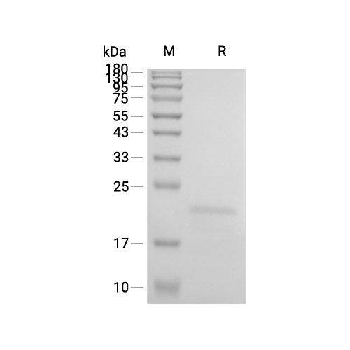 ZBP1蛋白, Human (His),ZBP1 Protein, Human (His)