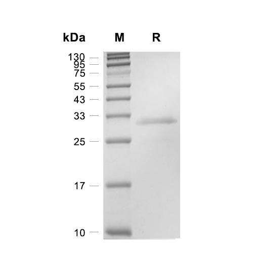 STAT6蛋白, Human (His),STAT6 Protein, Human (His)