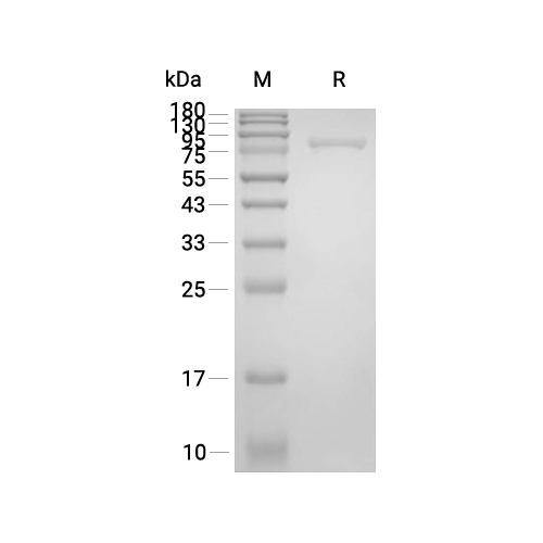THOP1蛋白, Human (His),THOP1 Protein, Human (His)