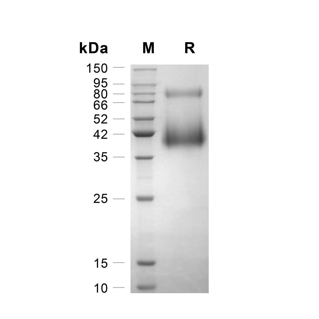 Granzyme D/GZMD蛋白, Mouse (HEK293, His),Granzyme D/GZMD Protein, Mouse (HEK293, His)