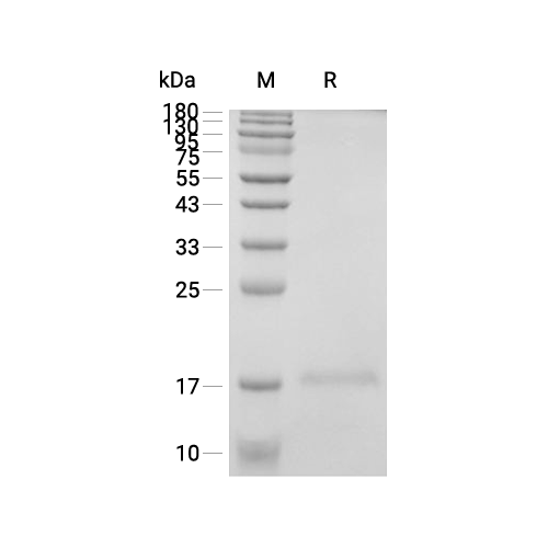 NPPB蛋白, Human (His, solution),NPPB Protein, Human (His, solution)