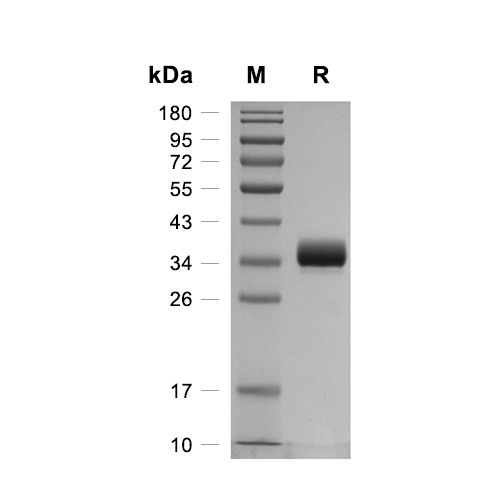 Tryptase beta-2蛋白, Mouse (HEK293, His),Tryptase beta-2 Protein, Mouse (HEK293, His)