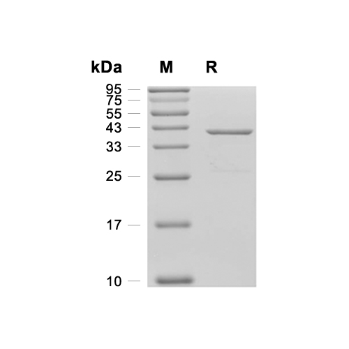 UBE2A蛋白, Human (GST-His),UBE2A Protein, Human (GST-His)