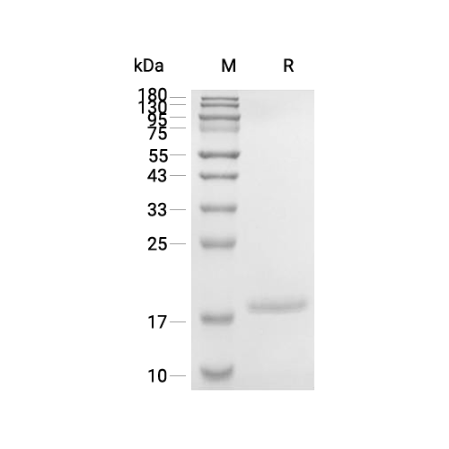 IL-1 beta蛋白, Human (solution),IL-1 beta Protein, Human (solution)