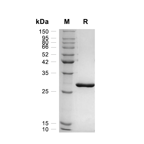 HMGB1/HMG-1蛋白, Human (His),HMGB1/HMG-1 Protein, Human (His)
