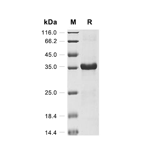 CLEC4C蛋白, Human (His-SUMO),CLEC4C Protein, Human (His-SUMO)
