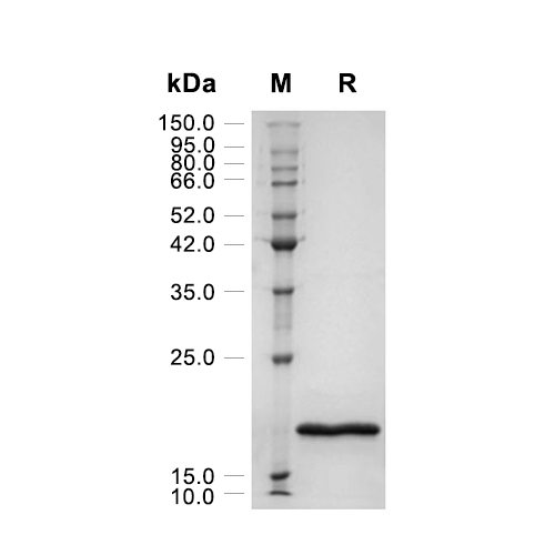 CDKN2A蛋白, Human,CDKN2A Protein, Human