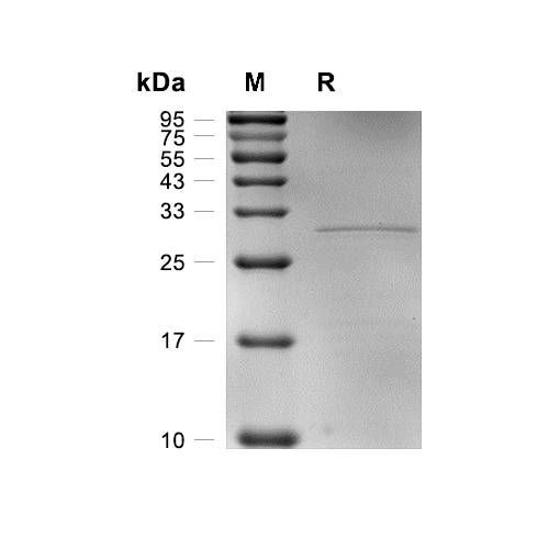 METRNL/Meteorin-like蛋白, Mouse (His),METRNL/Meteorin-like Protein, Mouse (His)