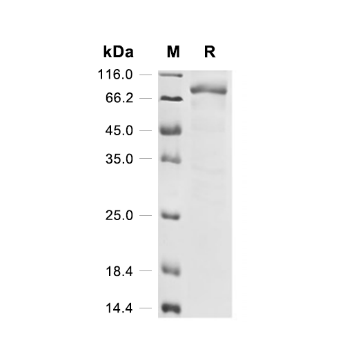 Histone deacetylase 1/HDAC1蛋白, Human (His-SUMO),Histone deacetylase 1/HDAC1 Protein, Human (His-SUMO)