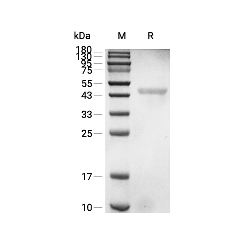 PPM1A蛋白, Human (His),PPM1A Protein, Human (His)