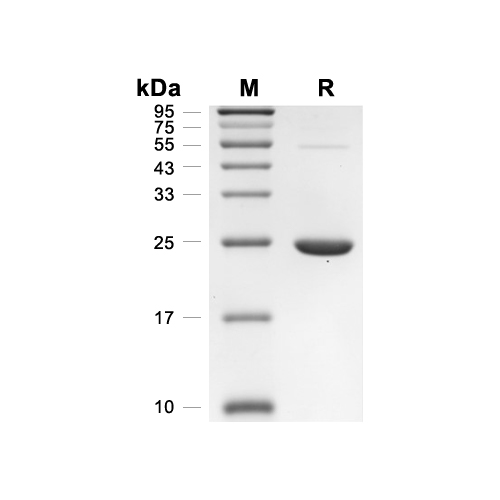 GSTP1蛋白, Human (His),GSTP1 Protein, Human (His)