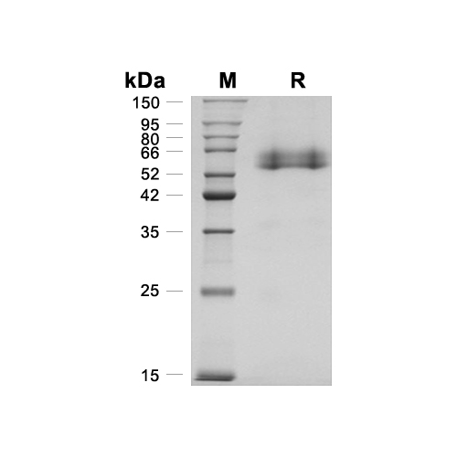 OLFM4蛋白, Human (HEK293, His),OLFM4 Protein, Human (HEK293, His)