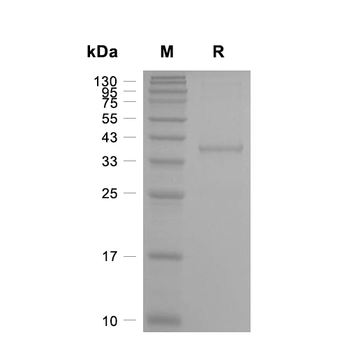 SCGB3A2蛋白, Mouse (His, GST),SCGB3A2 Protein, Mouse (His, GST)