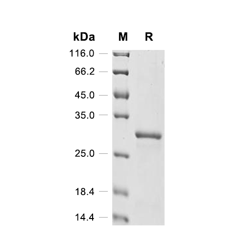 Chymase/CMA1蛋白, Mouse (His),Chymase/CMA1 Protein, Mouse (His)