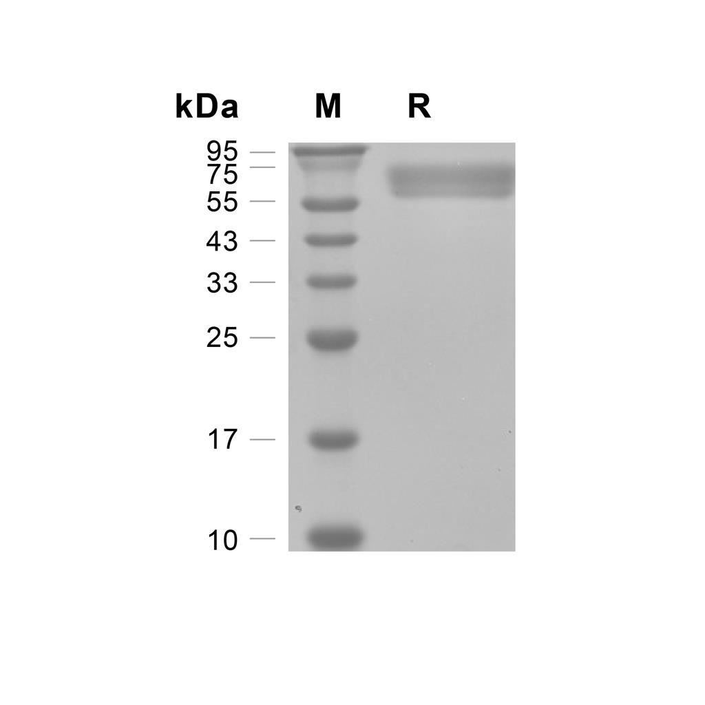 BACE1蛋白, Human (HEK293),BACE1 Protein, Human (HEK293)
