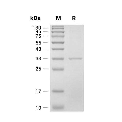 Carbonic Anhydrase 4蛋白, Human (HEK293, His),Carbonic Anhydrase 4 Protein, Human (HEK293, His)