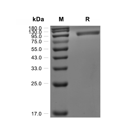 FGFR-4蛋白, Human (HEK293, Fc),FGFR-4 Protein, Human (HEK293, Fc)