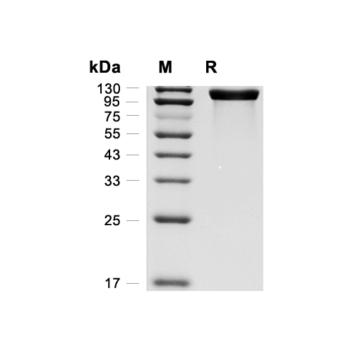 LDLR蛋白, Mouse (HEK293, His),LDLR Protein, Mouse (HEK293, His)