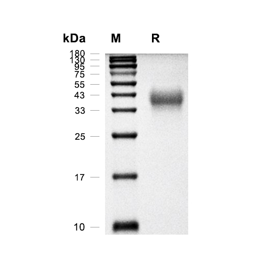 PD-1蛋白, Rhesus Macaque (HEK293, His),PD-1 Protein, Rhesus Macaque (HEK293, His)