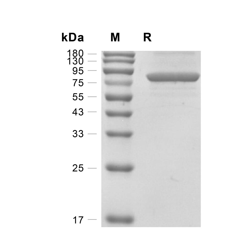 Transferrin蛋白, Rat (HEK293, His),Transferrin Protein, Rat (HEK293, His)