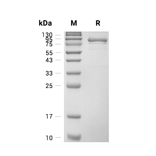 YES1蛋白, Human (sf9, His-GST),YES1 Protein, Human (sf9, His-GST)