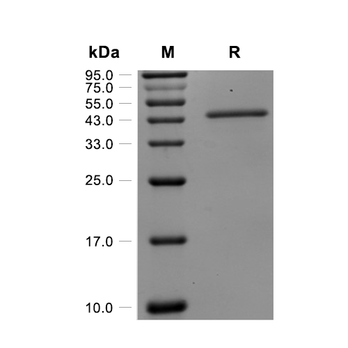 PDGF-CC蛋白, Mouse (HEK293, Fc),PDGF-CC Protein, Mouse (HEK293, Fc)