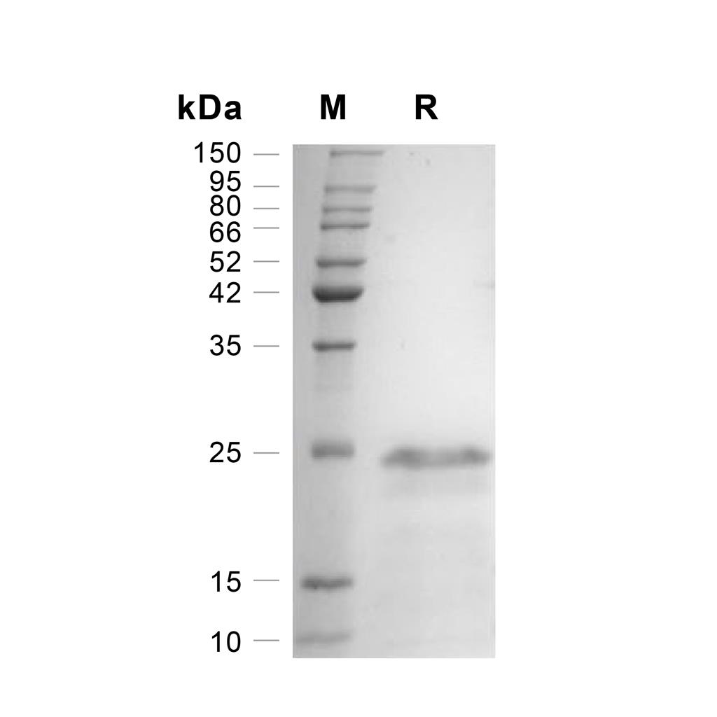 IL-18蛋白, Rhesus Macaque (His),IL-18 Protein, Rhesus Macaque (His)