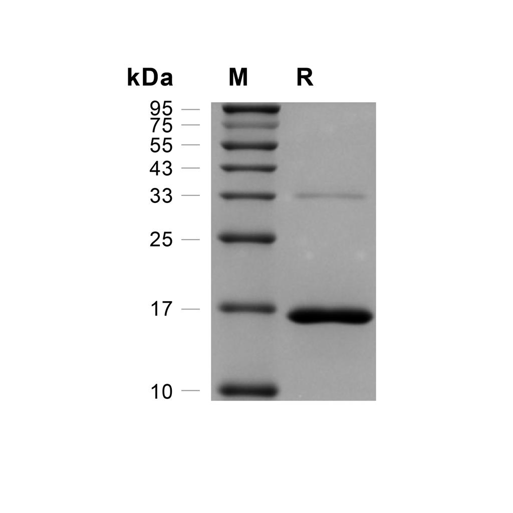 PTS蛋白, Human (His),PTS Protein, Human (His)