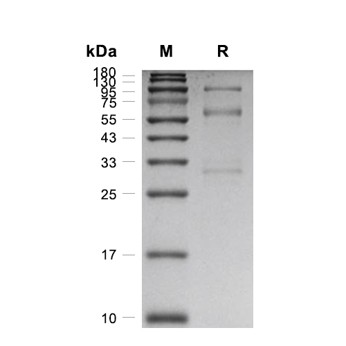 HGF蛋白, Mouse (HEK293),HGF Protein, Mouse (HEK293)