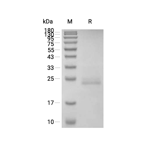 IFN-alpha 1/IFNA1蛋白, Mouse (P.pastoris, His),IFN-alpha 1/IFNA1 Protein, Mouse (P.pastoris, His)