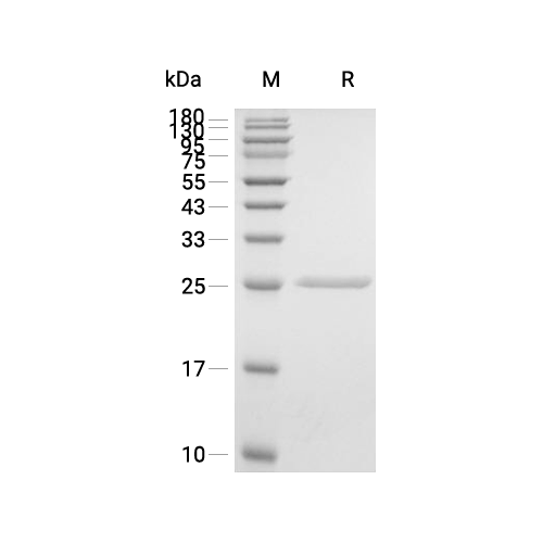 C-Reactive蛋白, Human (HEK293, solution),C-Reactive Protein, Human (HEK293, solution)