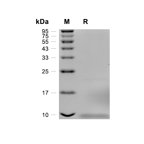 CD81蛋白, Human (HEK293, His),CD81 Protein, Human (HEK293, His)