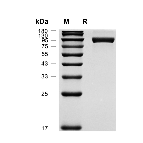 Neprilysin/CD10蛋白, Rat (HEK293, His),Neprilysin/CD10 Protein, Rat (HEK293, His)