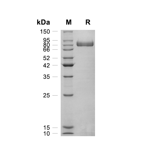 Complement factor H/CFH蛋白, Mouse (HEK293, Fc),Complement factor H/CFH Protein, Mouse (HEK293, Fc)