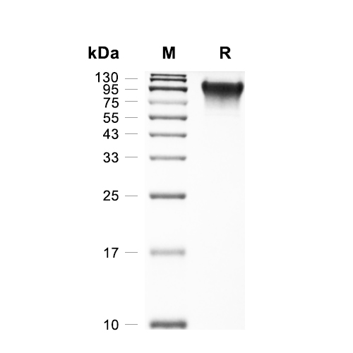 CD68蛋白, Rat (HEK293, His),CD68 Protein, Rat (HEK293, His)