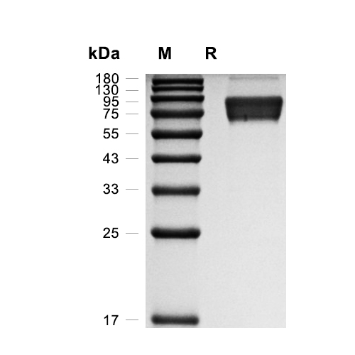 LYVE-1蛋白, Mouse (HEK293, Fc),LYVE-1 Protein, Mouse (HEK293, Fc)