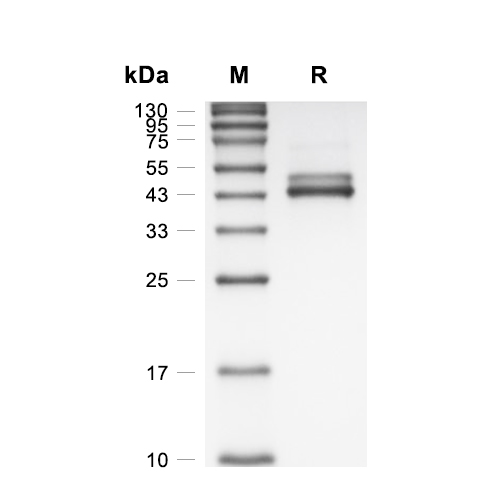 IL-12 beta蛋白, Rabbit (HEK293, His),IL-12 beta Protein, Rabbit (HEK293, His)