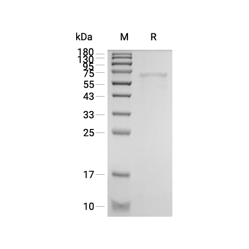 HSP60蛋白, Mouse (His, solution),HSP60 Protein, Mouse (His, solution)