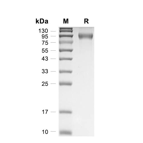 FLT3蛋白, Human (T227M, HEK293, His),FLT3 Protein, Human (T227M, HEK293, His)