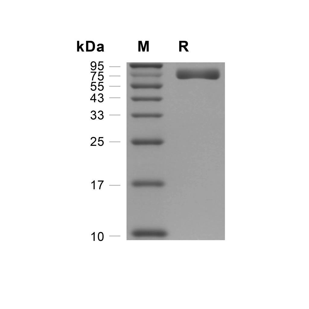 EphA4蛋白, Rat (HEK293, His),EphA4 Protein, Rat (HEK293, His)