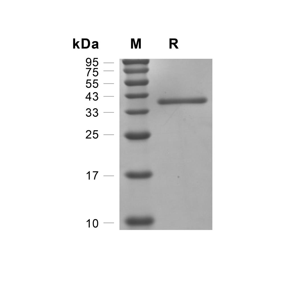 Cathepsin Z/CTSZ蛋白, Mouse (HEK293, His),Cathepsin Z/CTSZ Protein, Mouse (HEK293, His)
