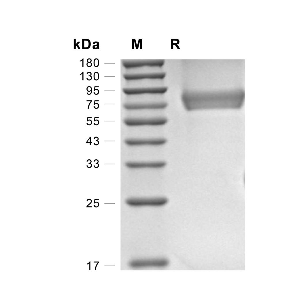 IFN-gamma R1/CD119蛋白, Rat (HEK293, Fc),IFN-gamma R1/CD119 Protein, Rat (HEK293, Fc)